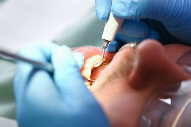 Best Same-Day Emergency Dental Services in Murraysville, NC