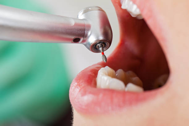 Best Emergency Gum Treatment in Murraysville, NC